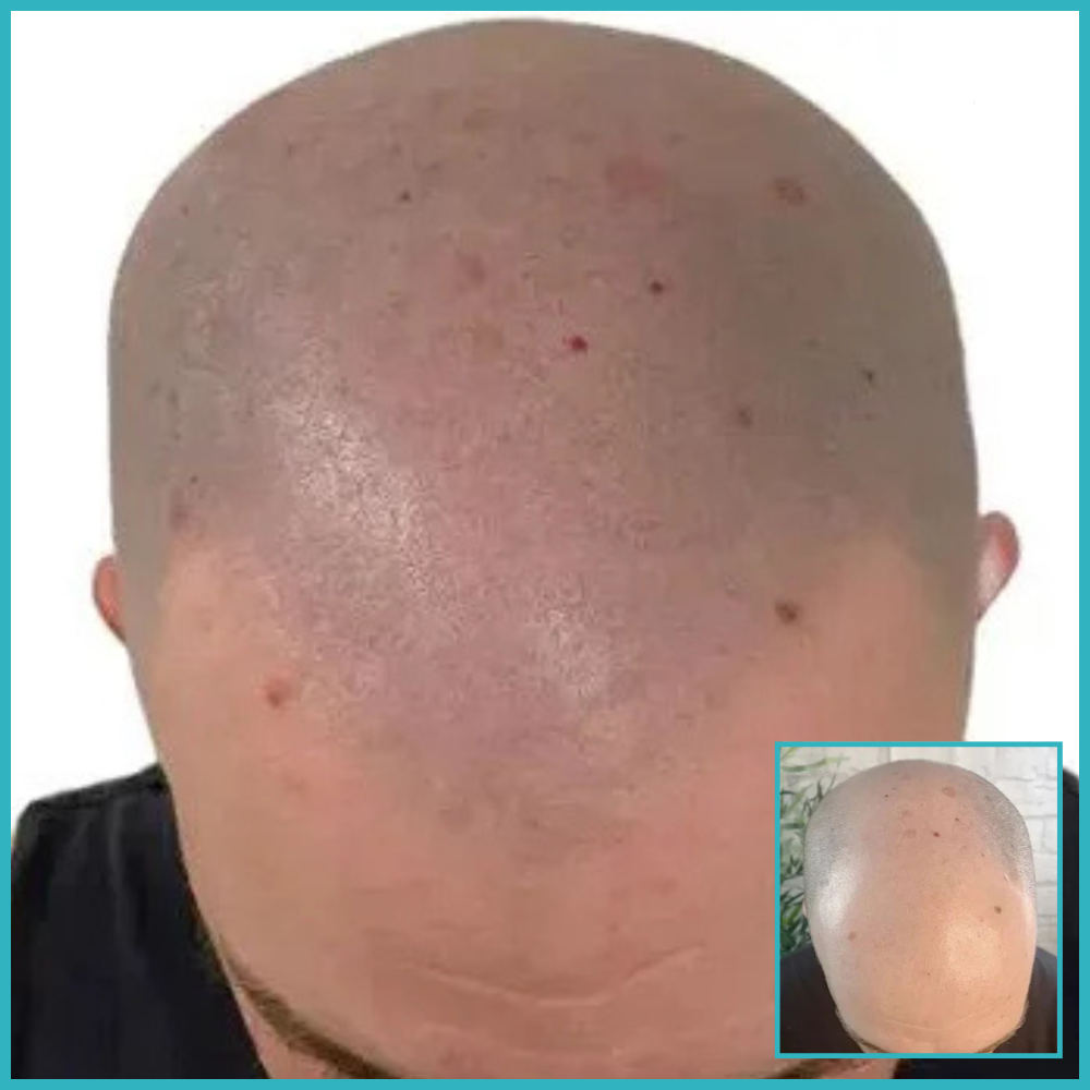 Before & After 1000x1000 - 2026-06-26T174323.810