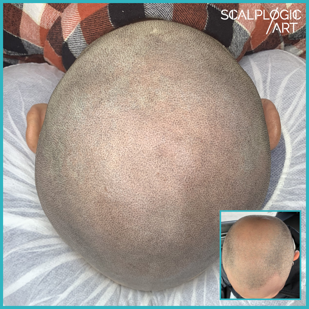 Before & After 1000x1000 - 2026-06-30T180337.468