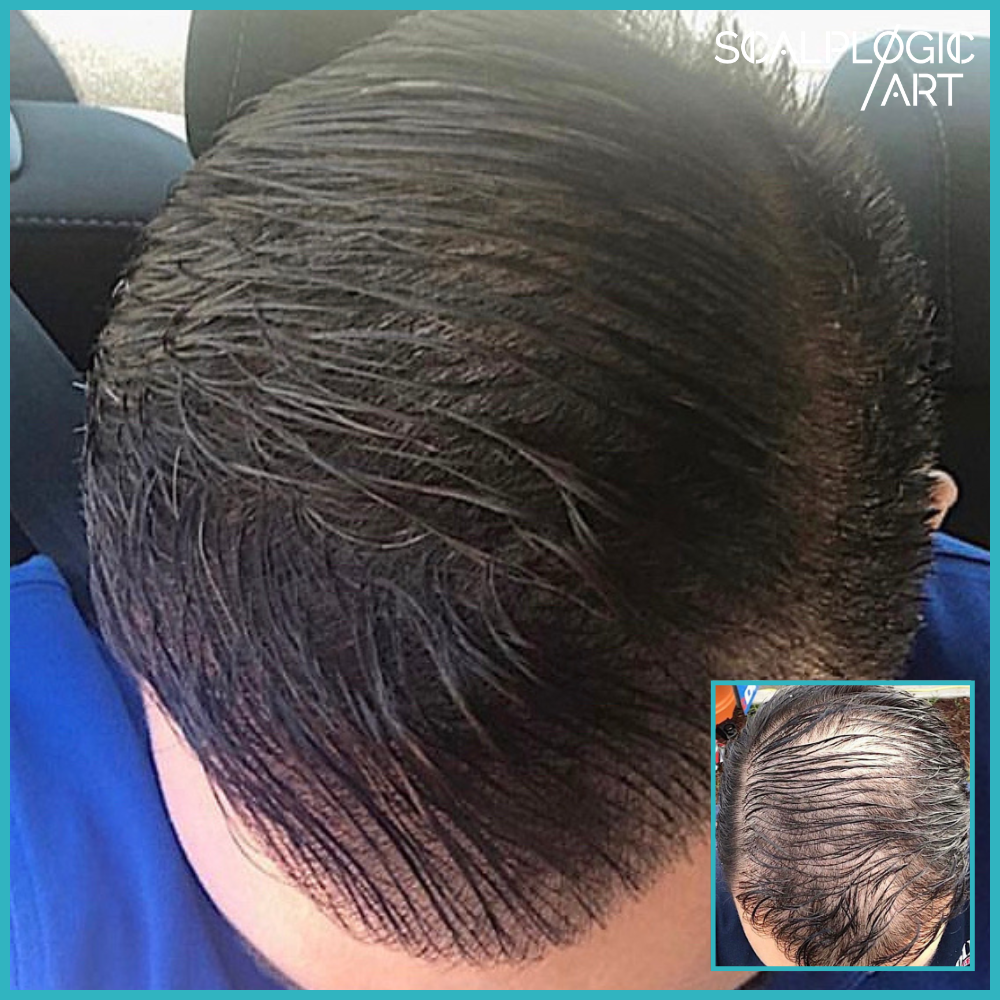 Before & After 1000x1000 - 2026-06-30T180430.712